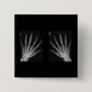 Bóton Quadrado 5.08cm X-ray digital extra para a direita e esquerda