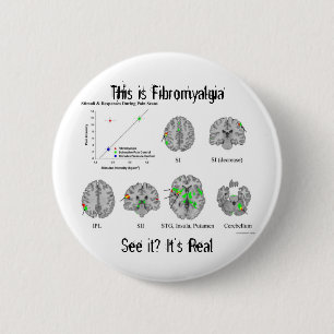 Bóton Redondo 5.08cm A fibromialgia é real. prova do fMRI