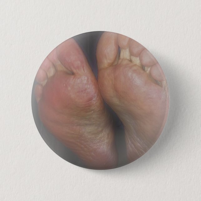 BÓTON REDONDO 5.08CM BOTÃO DE ALIMENTAÇÃO ÚNICA (Frente)