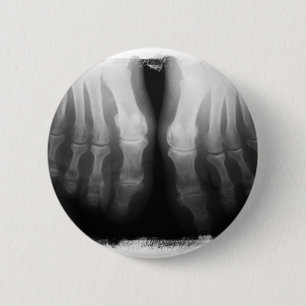 Bóton Redondo 5.08cm Preto & branco de esqueleto humanos de ossos dos