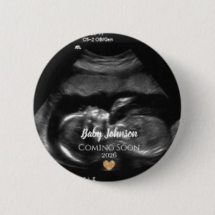 Bóton Redondo 5.08cm Ultrassom de Bebê Chegando Em Breve Coração de Our