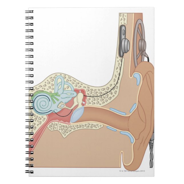 Caderno Espiral Implantes Cocleares (Frente)
