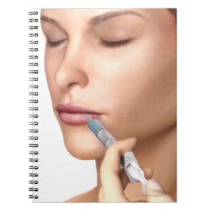 Caderno Espiral Injeções de Botox