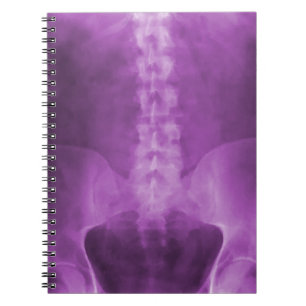 Caderno Espiral Notebook Roxo Digital X-Ray Art