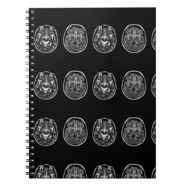 Caderno Espiral Scanner mri do cérebro (Frente)