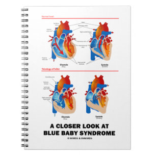 Caderno Espiral Um olhar mais atento na anatomia do coração da