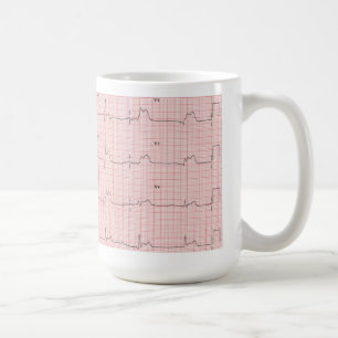 Café Caneca de ECG