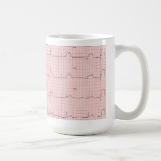 Café Caneca de ECG