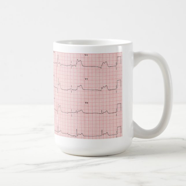 Café Caneca de ECG (Direita)
