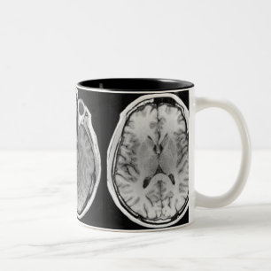 Café Em Dois Tons Caneca da imagem do cérebro de MRI
