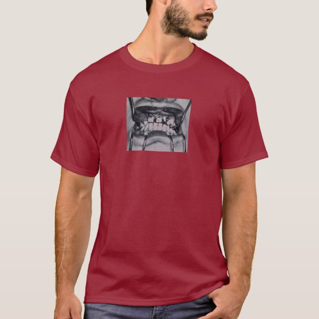 Camiseta Dentes quebrados irritados (Frente)