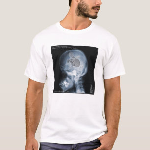 Camiseta Estudo de caso: Baterista