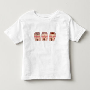 Camiseta Infantil Vista do que causa a acne
