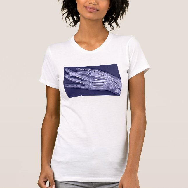 Camiseta "Não estou permitido eu dizer-lhe se quebrou " (Frente)