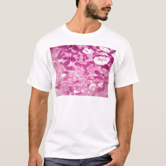 Camiseta Pilhas do nó de linfa sob o microscópio