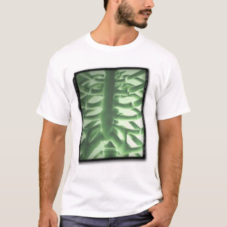 Camiseta Raio X de caixa portátil de ACWE