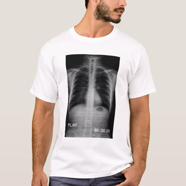 Camiseta “Retro VHS X-Ray” Old-school chest X-ray with VHS  (Frente)