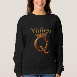 Camiseta Vitiligo Royalty