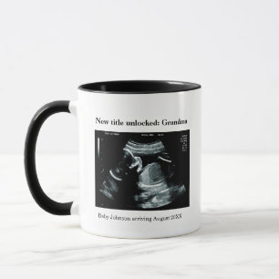 Caneca Anúncio de Gravidez com Ultrassom – Vai ser Vovó