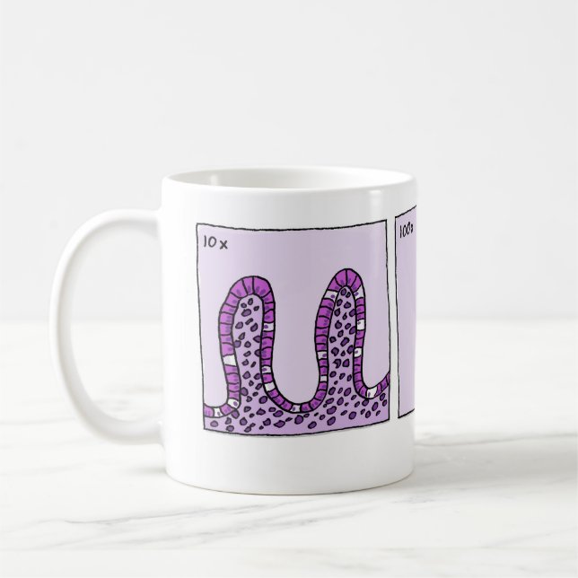 caneca de 1000x Immunohistochemistry (Esquerda)