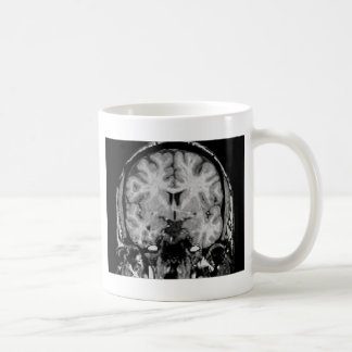 Caneca De Café Cérebro MRI, fatia coronal