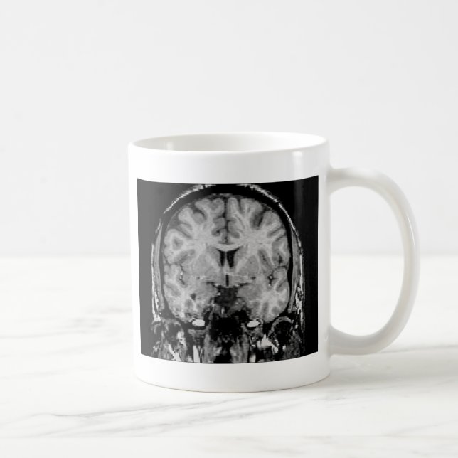 Caneca De Café Cérebro MRI, fatia coronal (Direita)