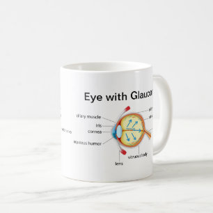 Caneca De Café Diagrama ocular para o Glaucoma e Olhos Saudáveis
