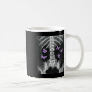 Caneca De Café Egirl Xray Skeleton Pink Butterfly Harajuku Y2k Da