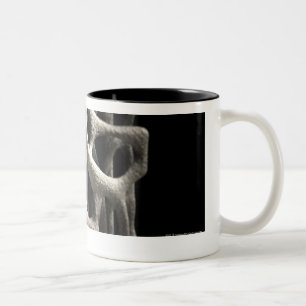 Caneca De Café Em Dois Tons Estrutura de um osso com osteoporose