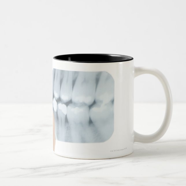Caneca De Café Em Dois Tons MODELO LIBERADO. Raio X dental (Direita)