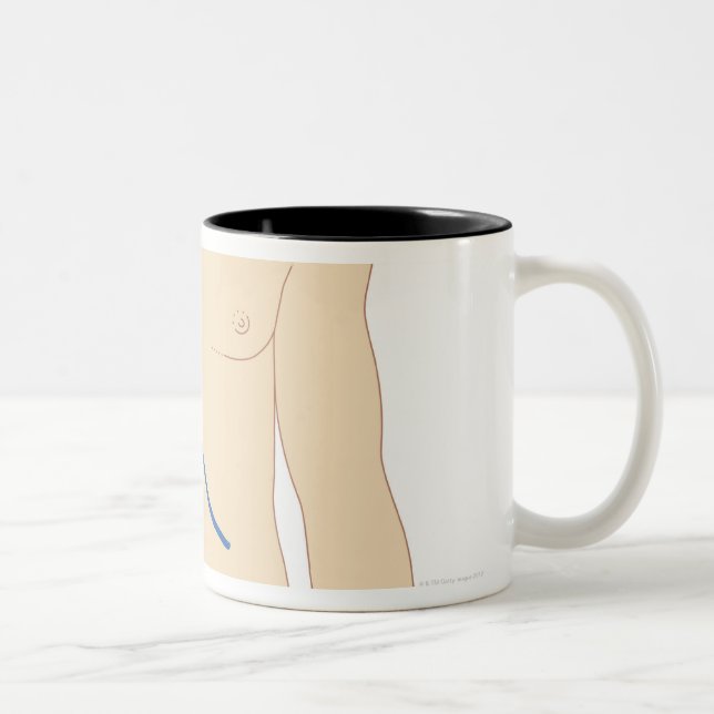Caneca De Café Em Dois Tons Transplantação do fígado (Direita)