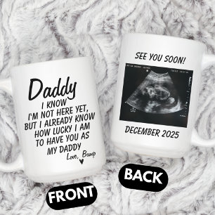 Caneca De Café Foto de Sonograma Personalizada, Foto de Ultrassom