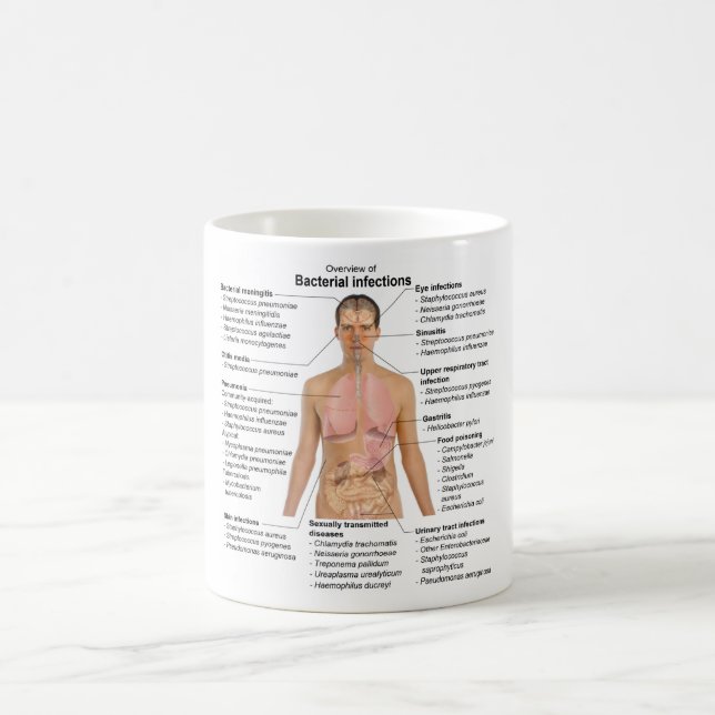 Caneca De Café Gráfico de infecções bacterianas em seres humanos (Centro)