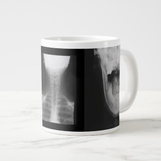 Caneca De Café Grande Raios X 3