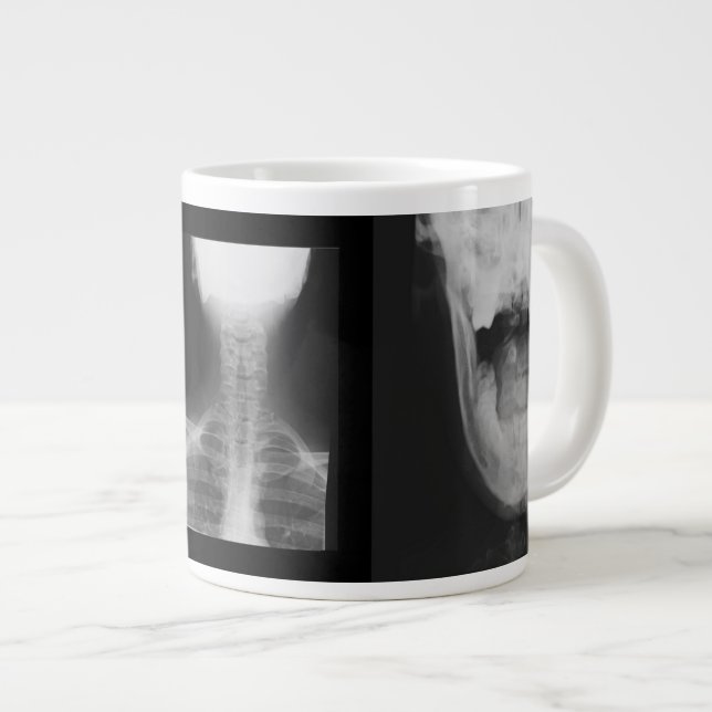 Caneca De Café Grande Raios X 3 (Frente Esquerda)