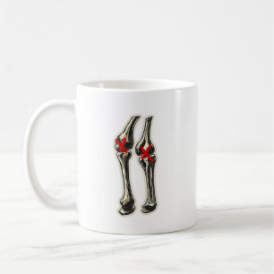 Caneca De Café Joelhos Ruins – Ilustração Divertida de Joelho de