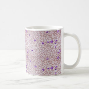Caneca de café - leucemia mielóide crônica (CML)