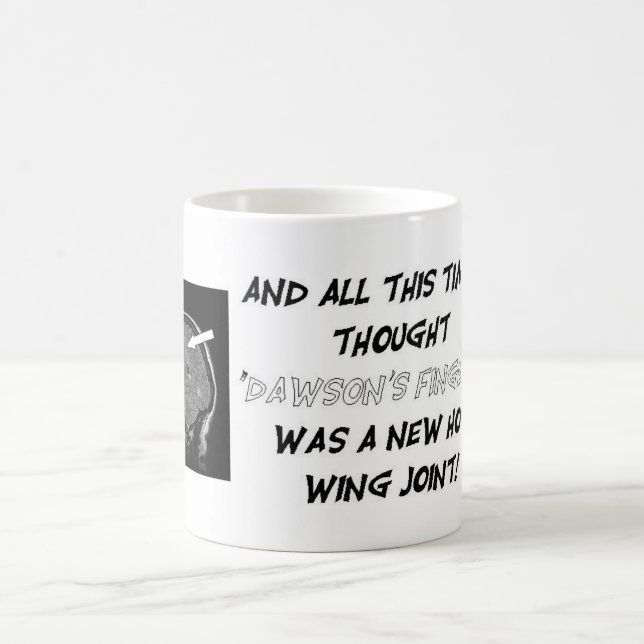 Caneca De Café Obtenha pessoal com sua carga da lesão! (Centro)