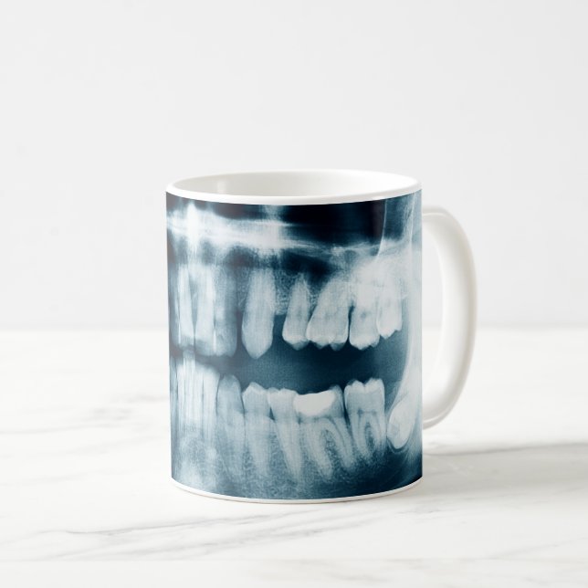 Caneca De Café Raio-X dos dentes (Frente Esquerda)