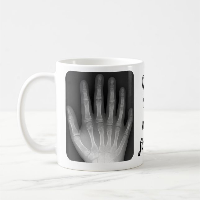 Caneca De Café Raio X Polydactyl da mão (Esquerda)