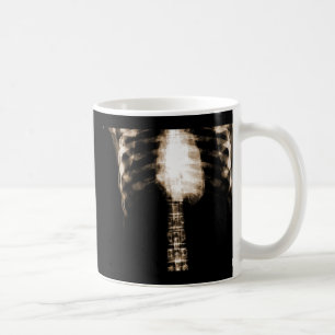 CANECA DE CAFÉ REFORÇOS DE ESQUELETO DO TORSO DO RAIO X - SEPIA
