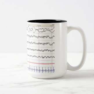 Caneca de EEG - sono do REM