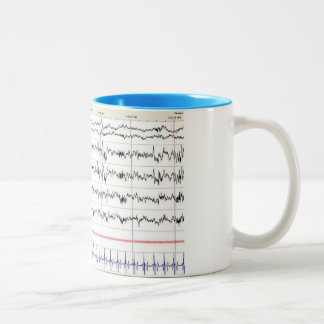 Caneca do sono EEG - sono do palco 2