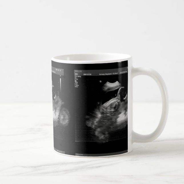 Caneca do Sonogram da motocicleta (Direita)