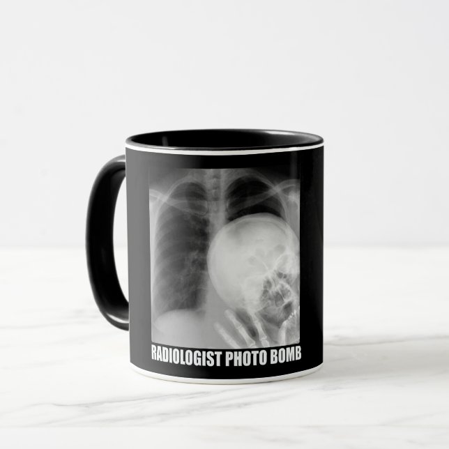 CANECA FOTO RADIOLOGISTA BOMBA (Frente Esquerda)