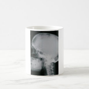Caneca Mágica Crânio do raio X