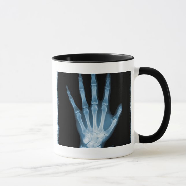Caneca Mão azul do esqueleto do raio X (Direita)