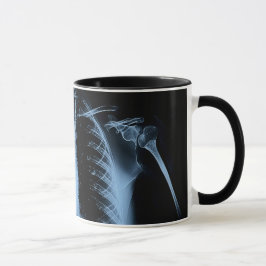 Caneca O raio-X