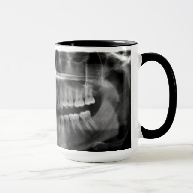 Caneca Radiografia Panoramica (Direita)