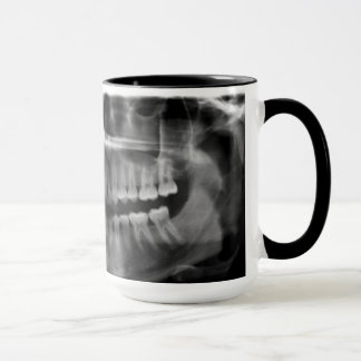 Caneca Radiografia Radiologia